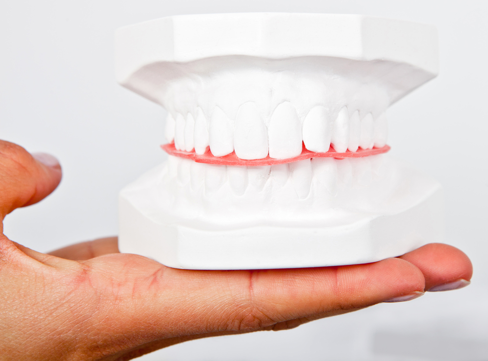 A demonstration of a red bite guard between two sets of teeth